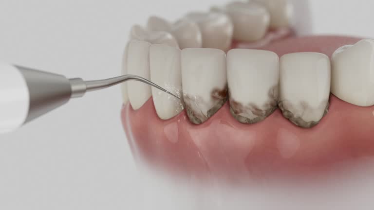 Reliable Teeth Cleaning And Checkup contractor in Burke County County, GA by Dentist Open Now